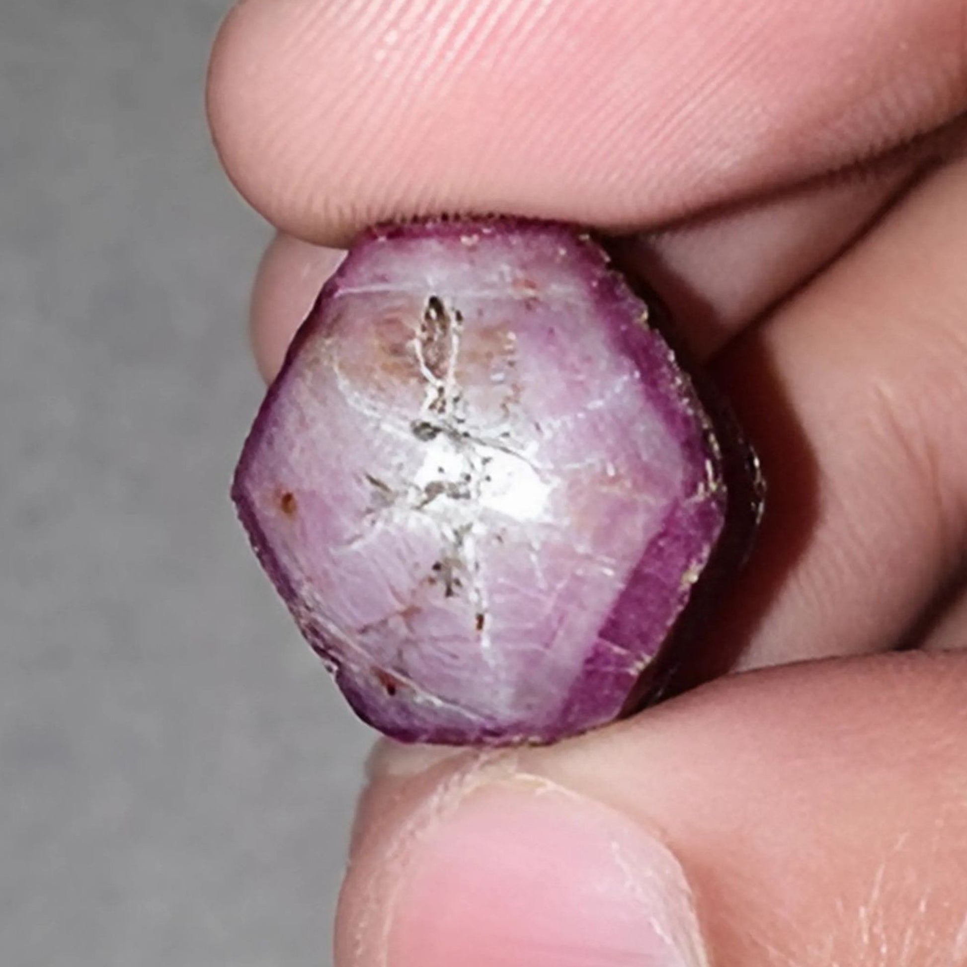 Sternrubin-Heilstein